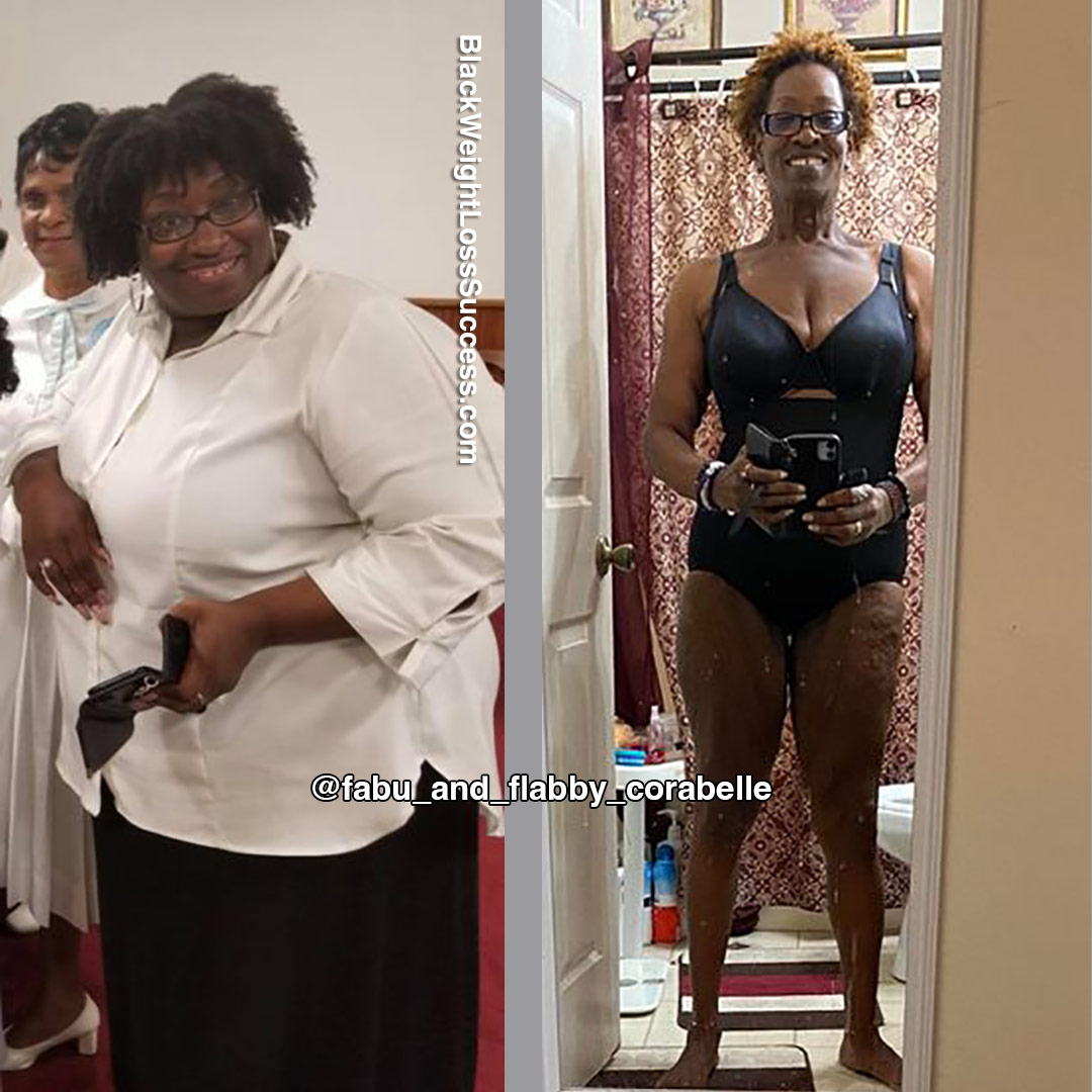 Sacora before and after weight loss