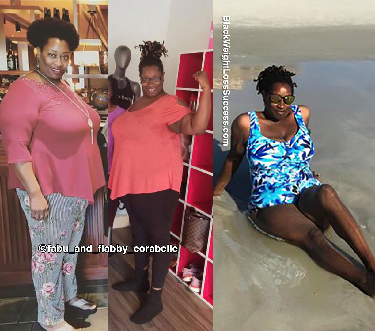 Sacora before and after weight loss