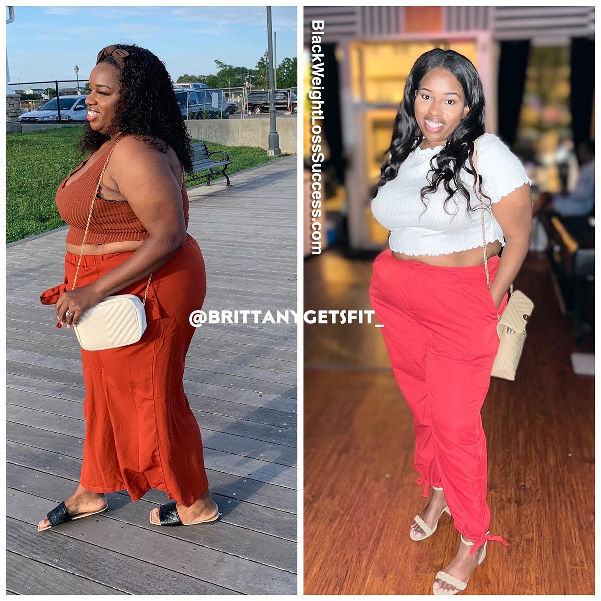 gastric bypass before and after black women