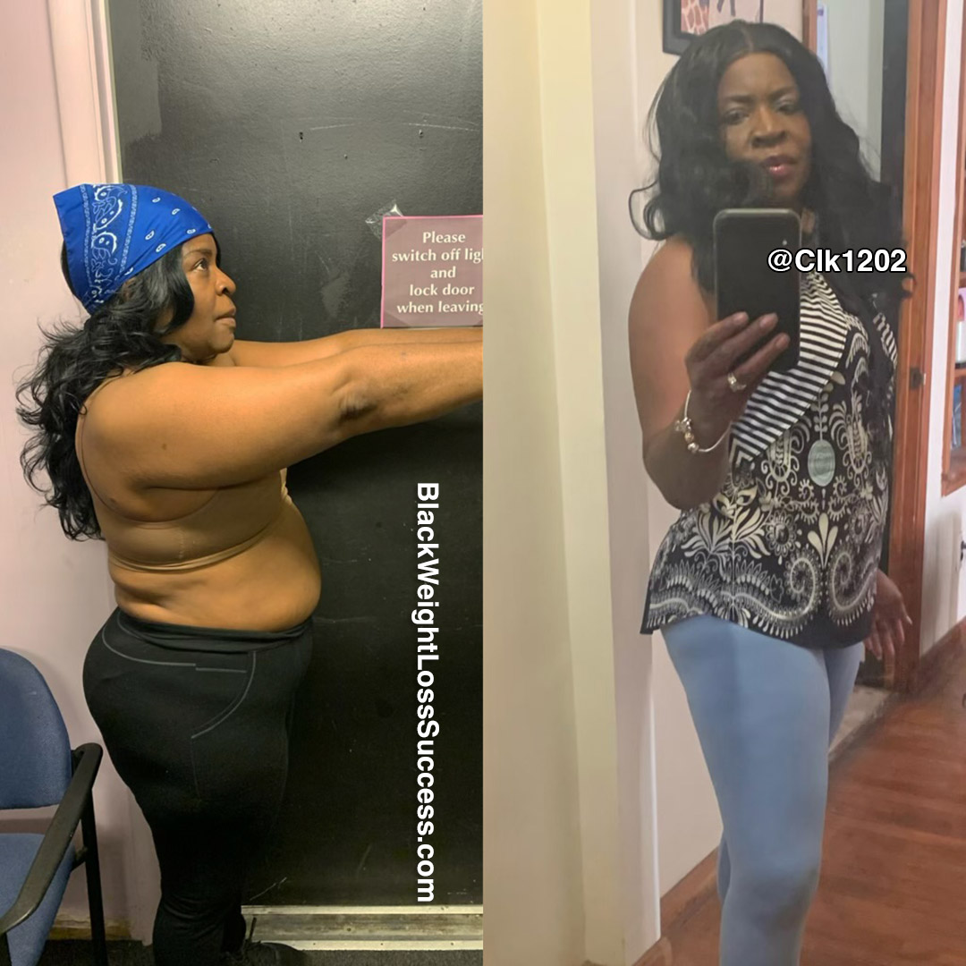 Cynthia before and after weight loss