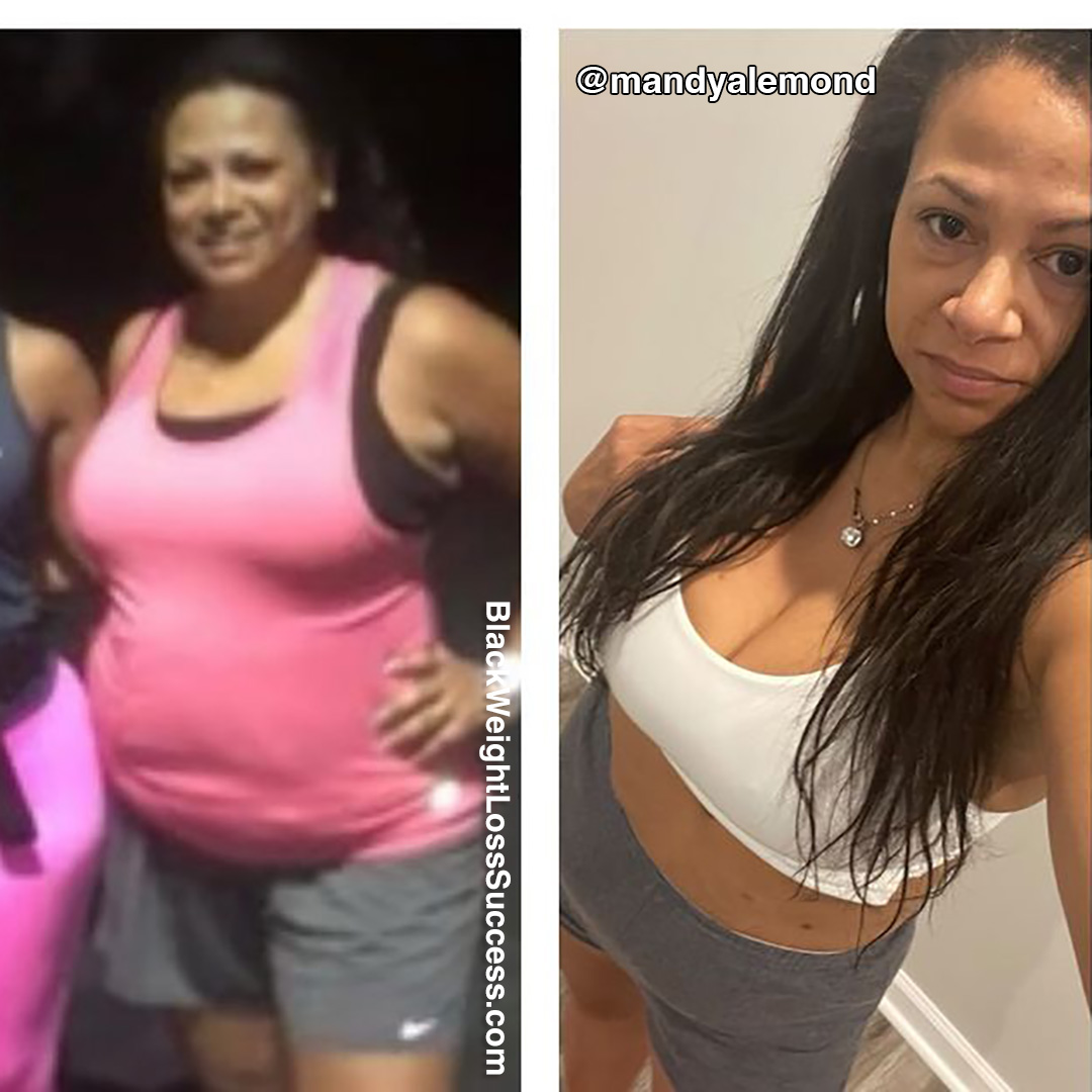 Mandy before and after weight loss