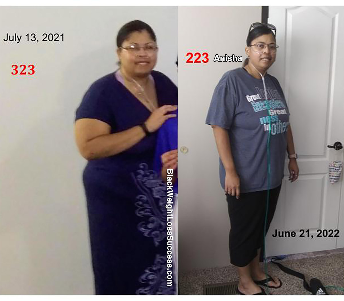 Anisha before and after weight loss