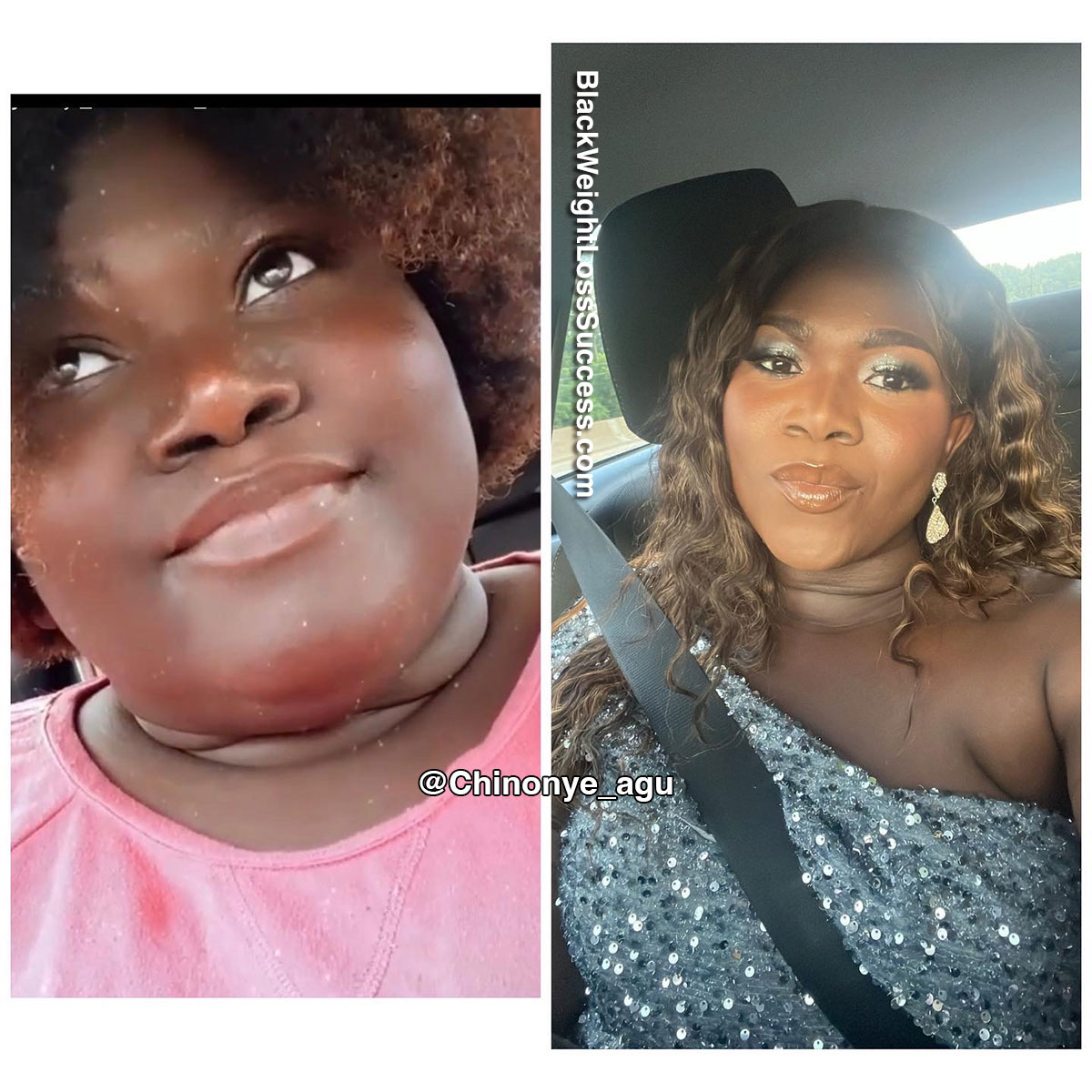 Chinonye before and after weight loss