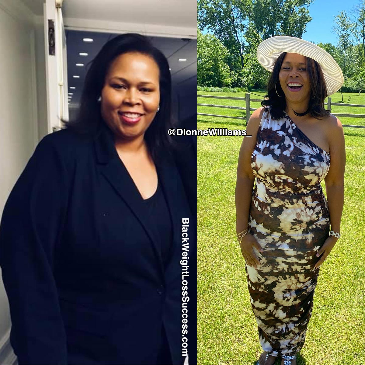 Dionne before and after weight loss