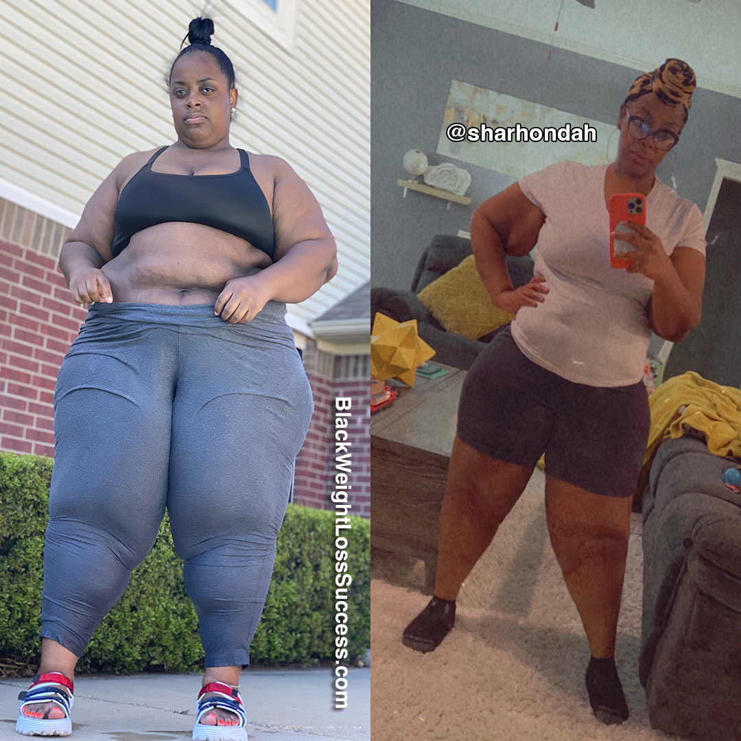 ShaRhonda before and after gastric sleeve
