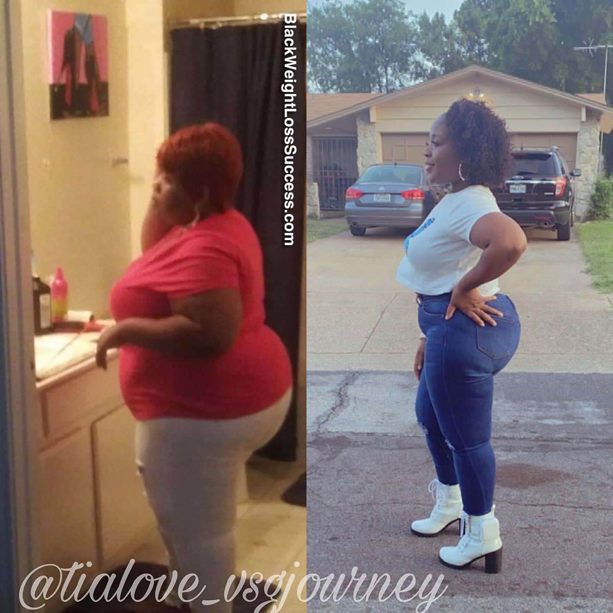 Tiandra before and after weight loss