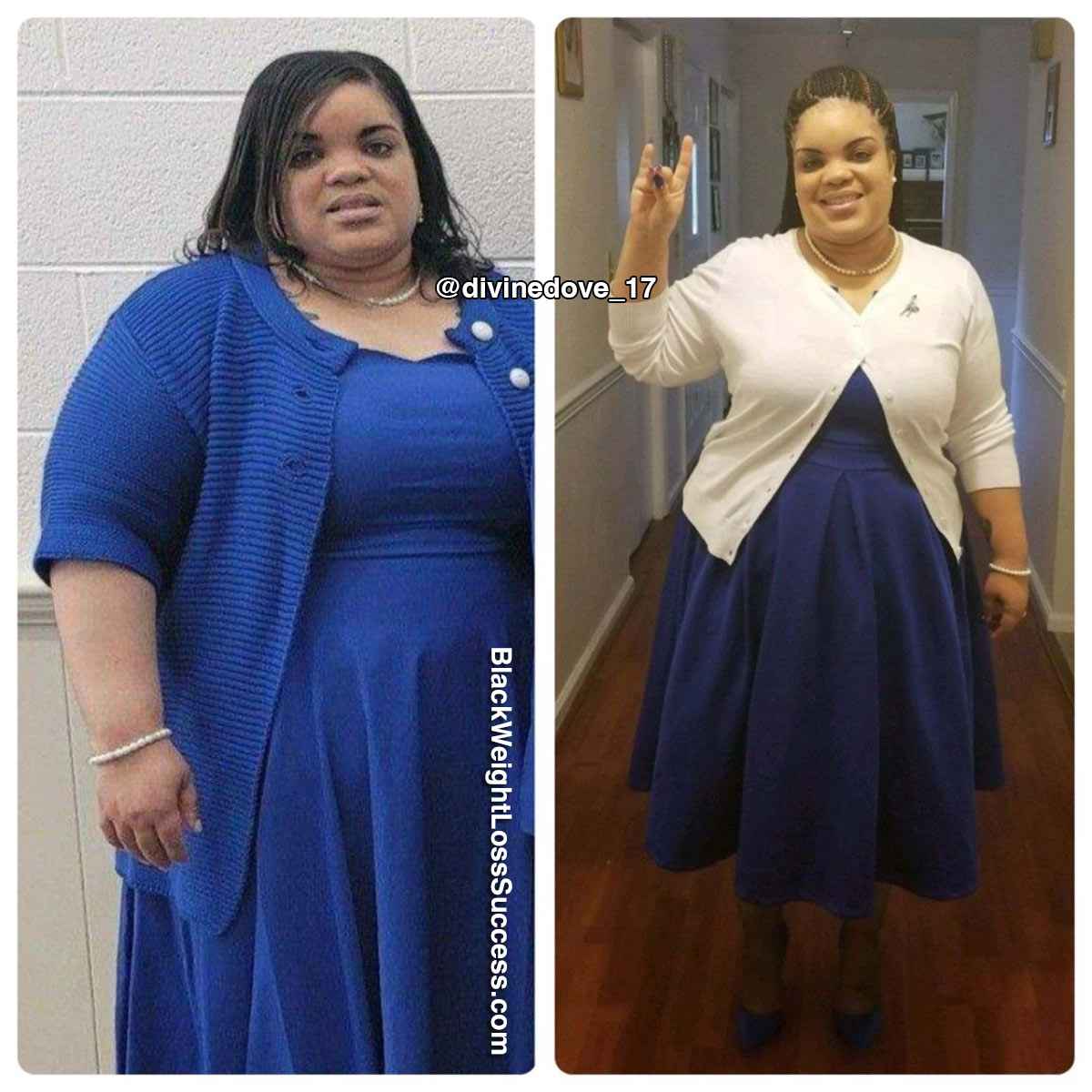 Vanessa before and after weight loss