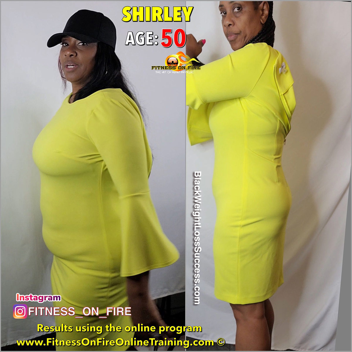 Shirley before and after weight loss