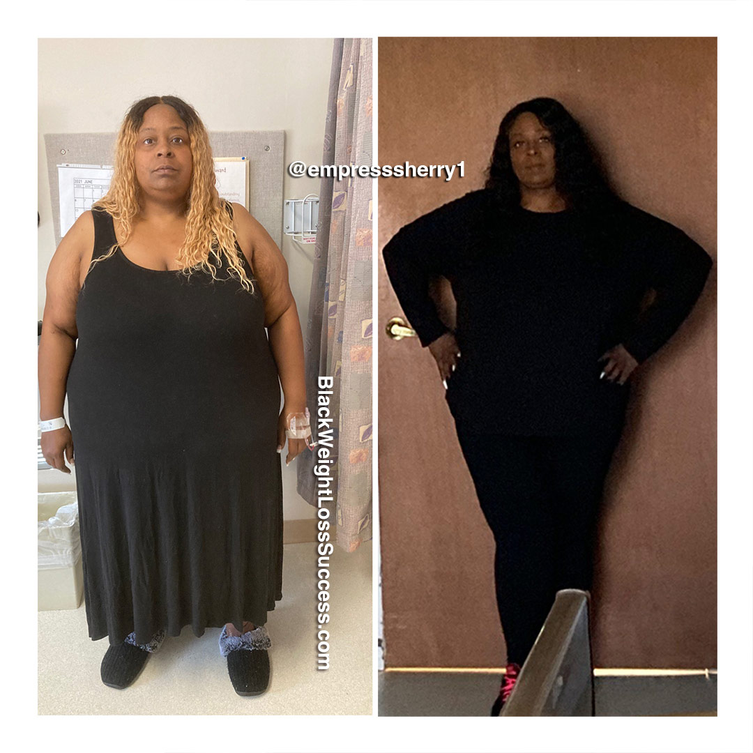 Sherry before and after weight loss