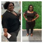 Beverly before and after weight loss