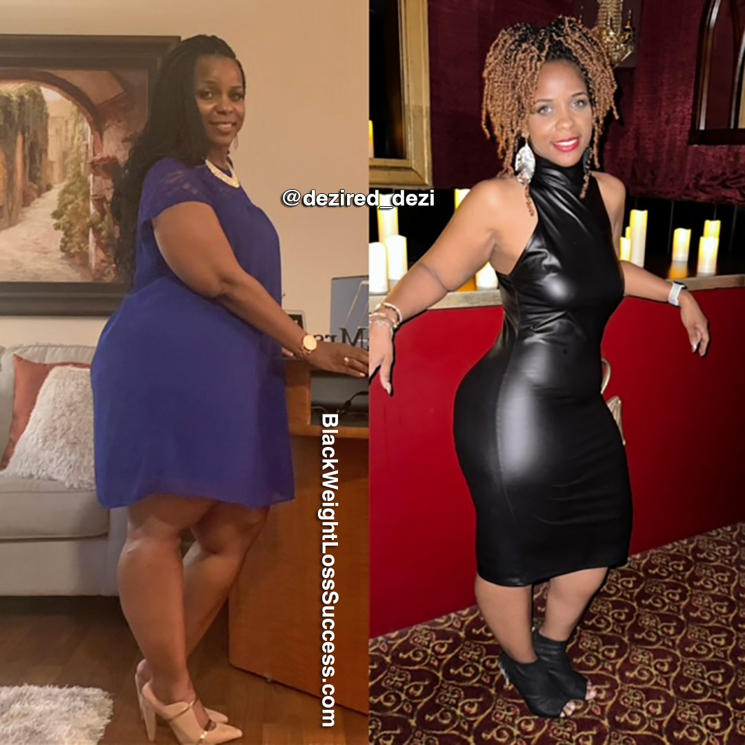 Dezi before and after weight loss