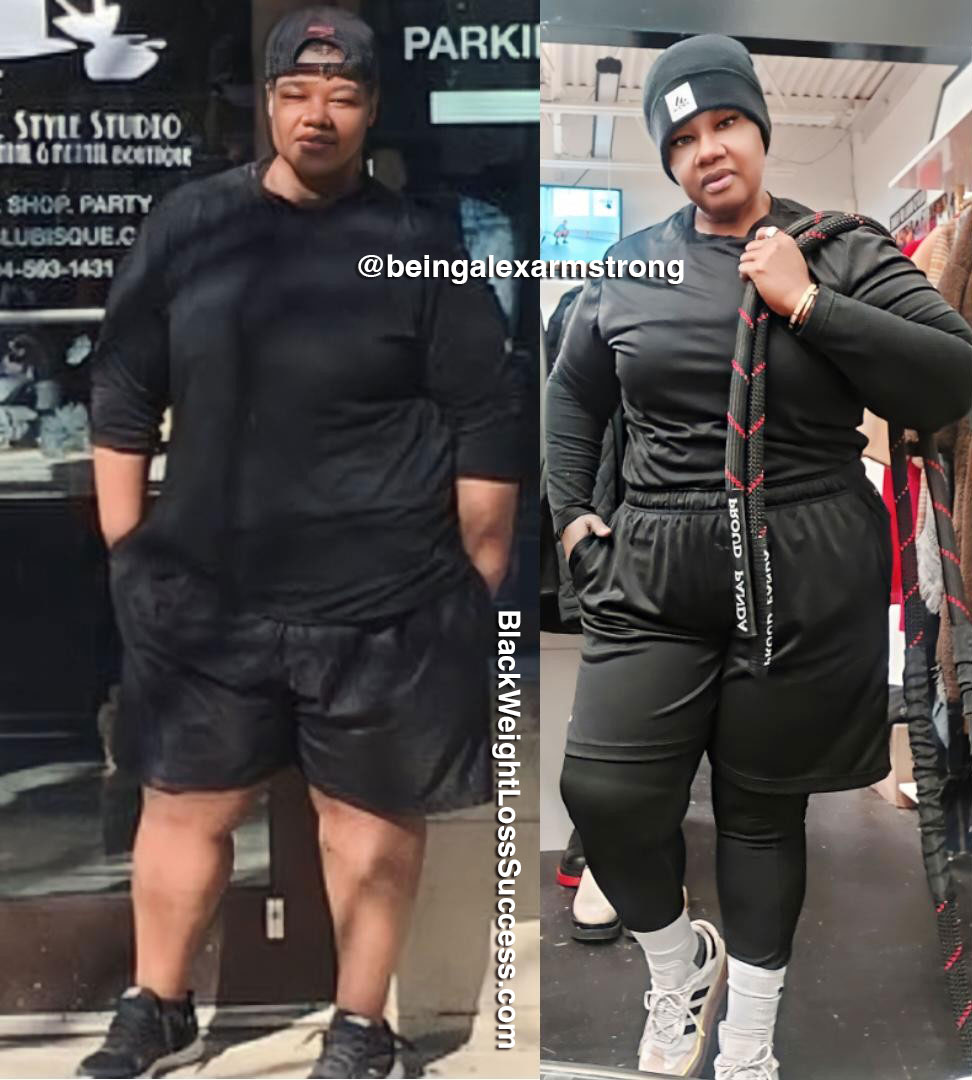 Alex before and after weight loss