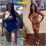 Sandra before and after weight loss