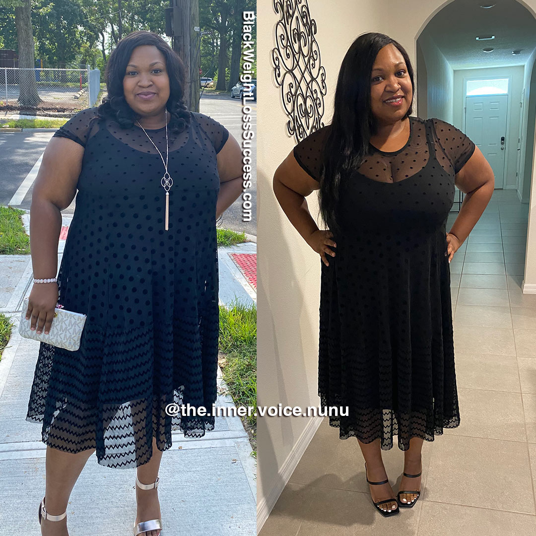 synara before and after weight loss