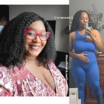 Mynetria before and after weight loss