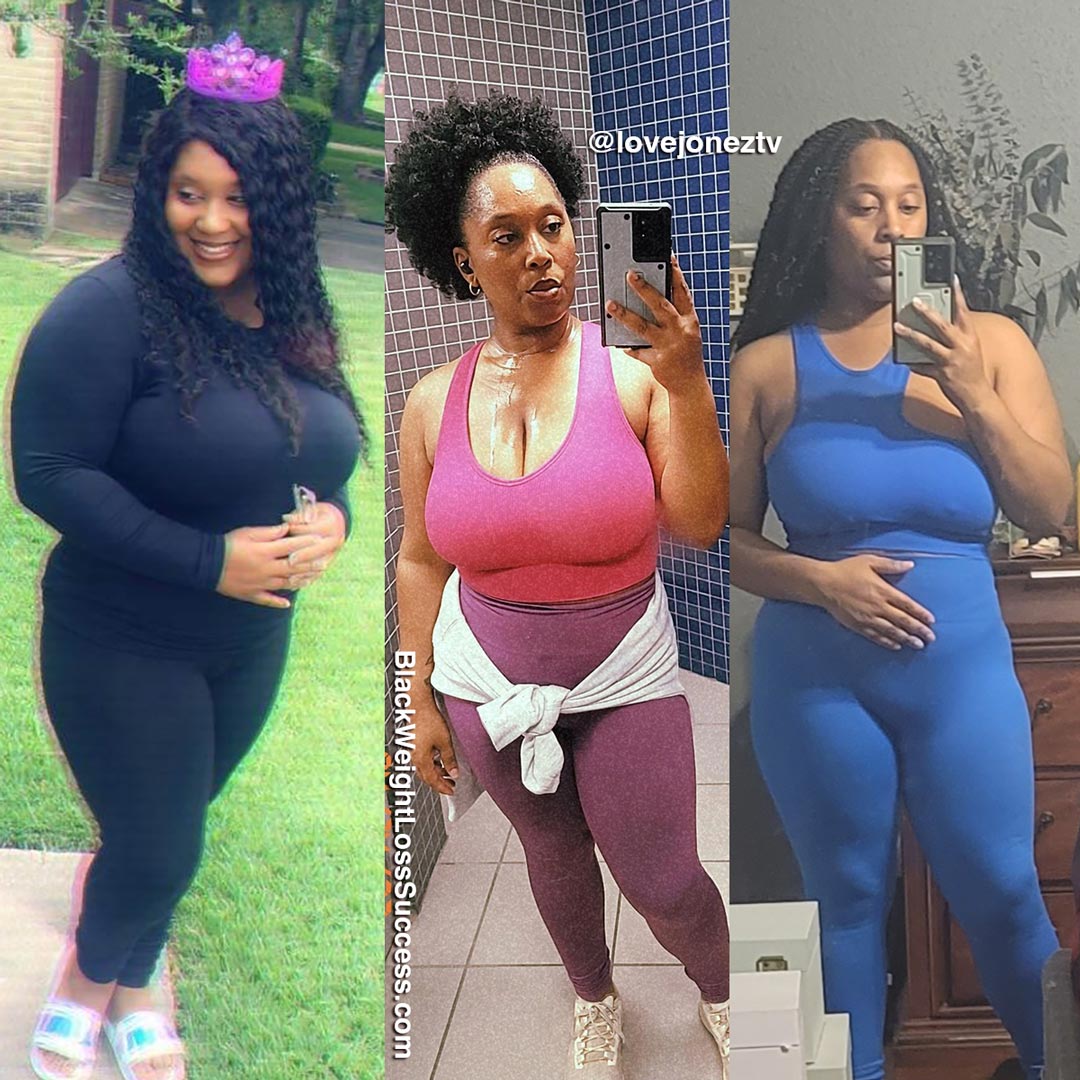 Mynetria before and after weight loss