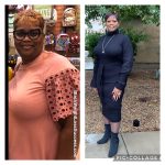 Rhonda before and after weight loss