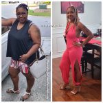 Theresa before and after weight loss