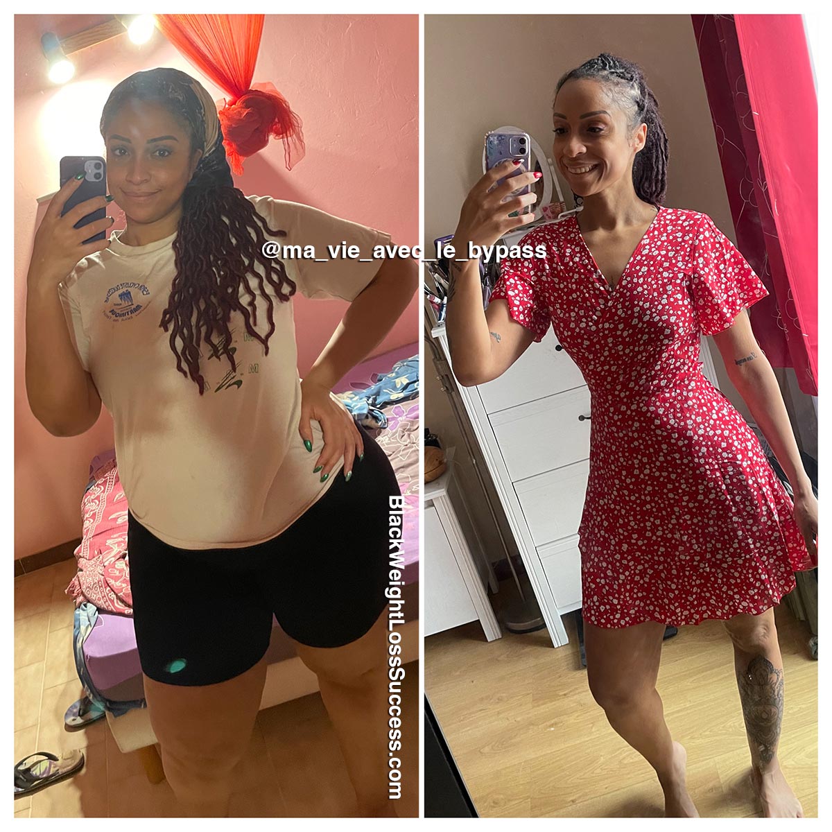 Axelle before and after weight loss