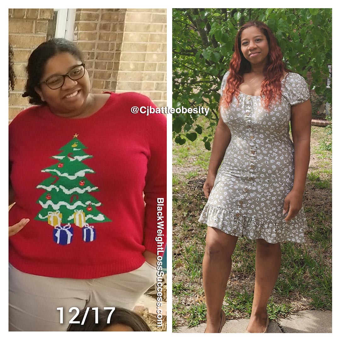 Carla before and after weight loss