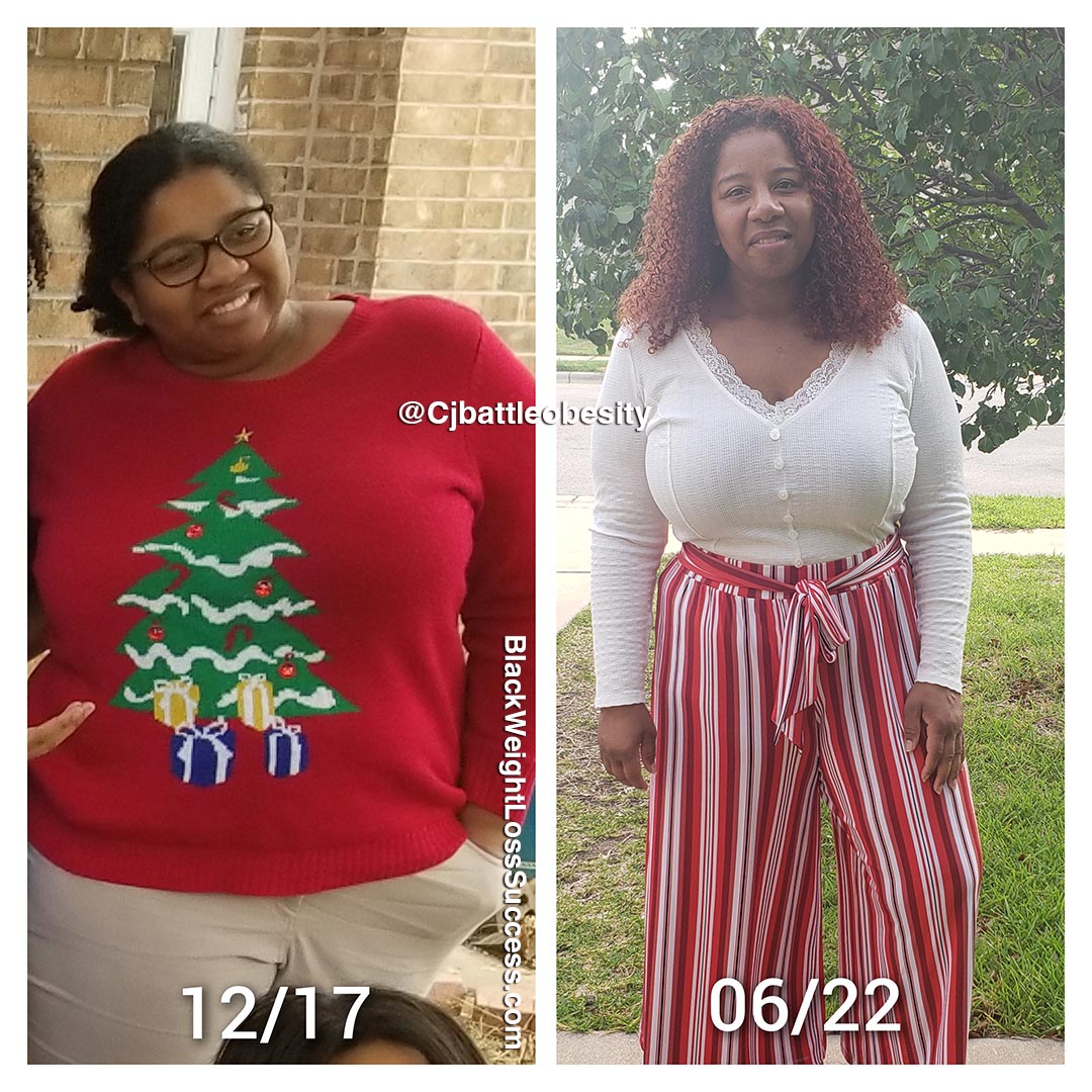 Carla before and after weight loss