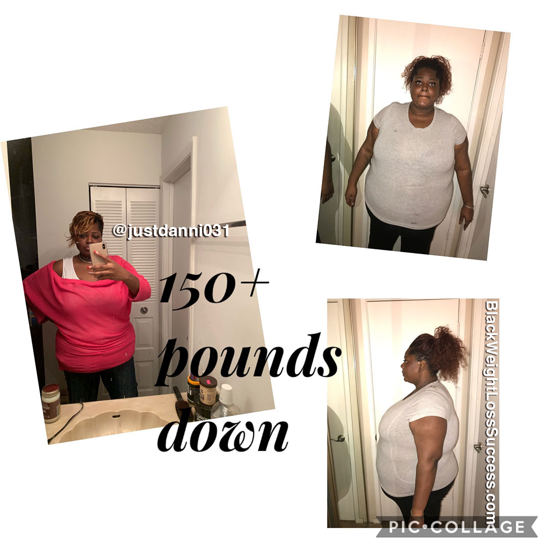 Danyelle after losing 150 pounds