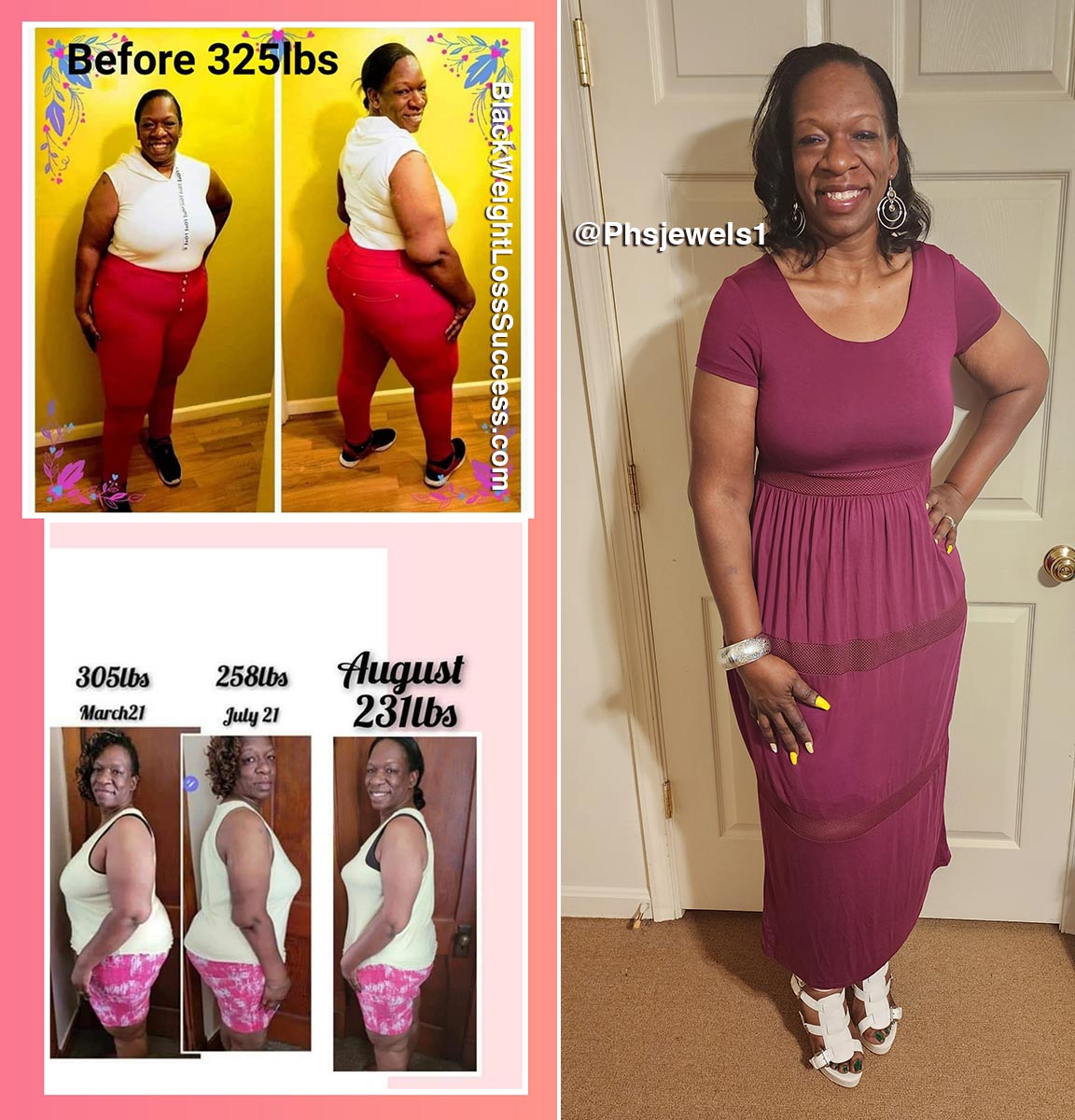 Treva before and after weight loss surgery