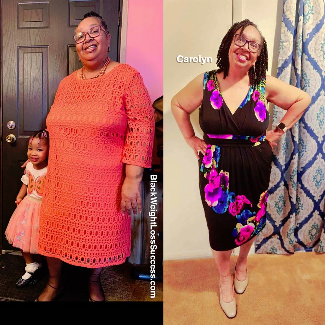 Photo of Carolyn misplaced 80 kilos | Black Weight Loss Success