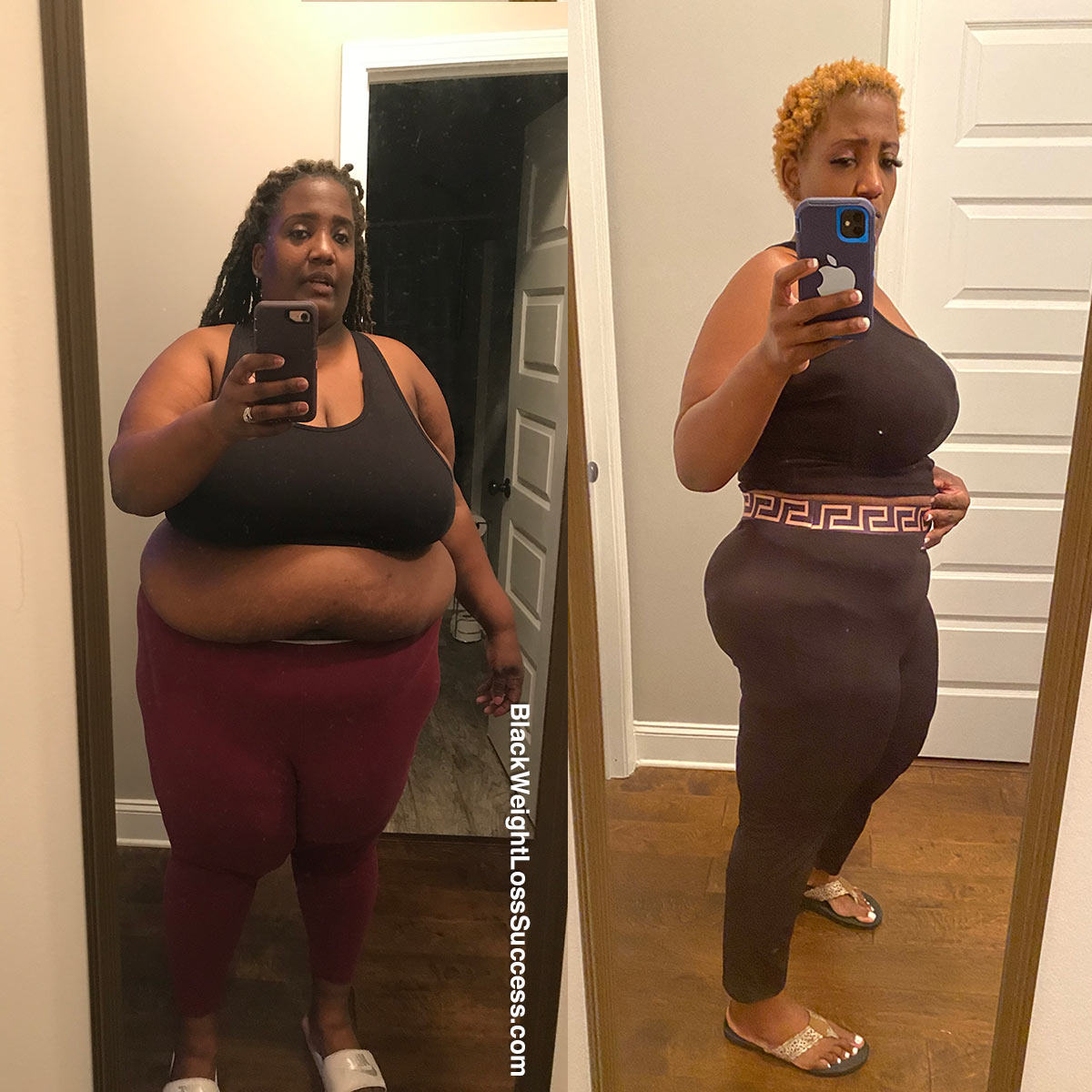 Wiltonja before and after weight loss