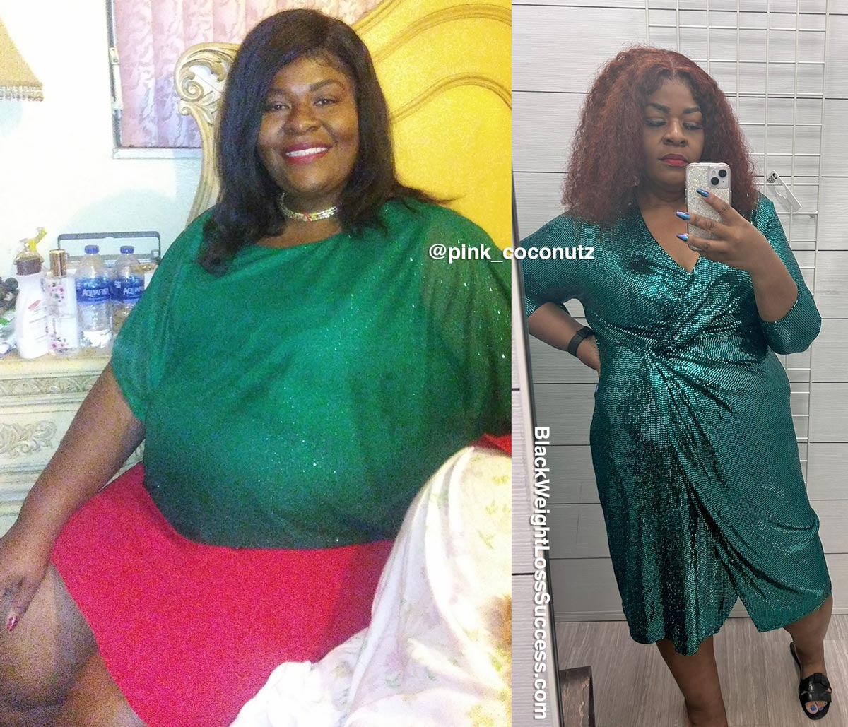 Photo of Woodlyne misplaced 68 kilos | Black Weight Loss Success