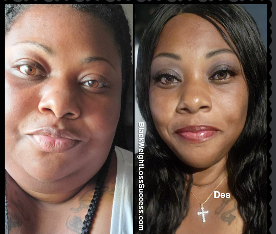 Des before and after weight loss