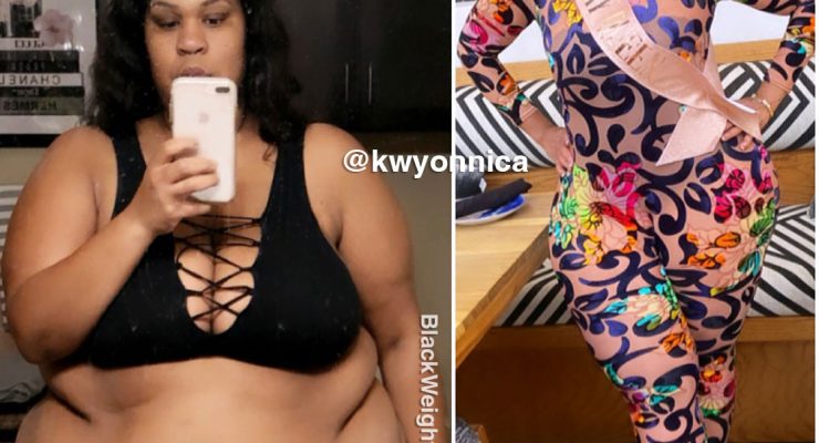 Kwyonnica before and after weight loss
