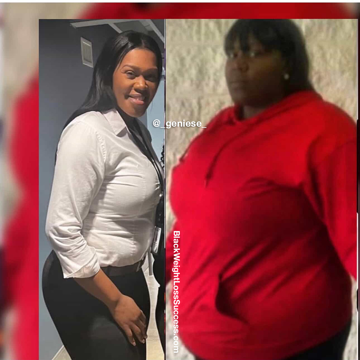 Geniese before and after